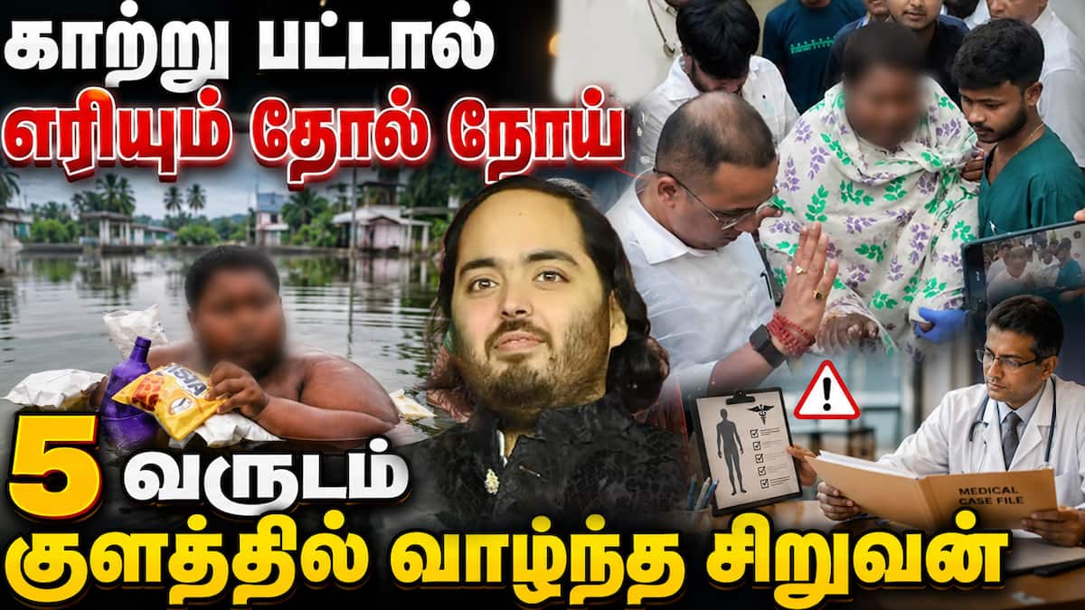 அம்பானி மகன் மீட்ட விசித்திர சிறுவன்