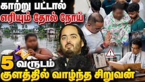 விசித்திர சிறுவனை மீட்ட அம்பானி மகன் - நெகிழ வைக்கும் சம்பவம்   