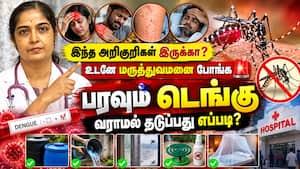 டெங்கு பாராமல் தடுக்க அரசு மருத்துவர் சிறப்பு விளக்கம்  