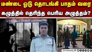 அஜித்குமார் பிரேத பரிசோதனையில் பகீர் தகவல்  