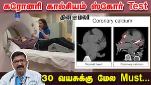 கரோனரி கால்சியம் ஸ்கோர் Test  